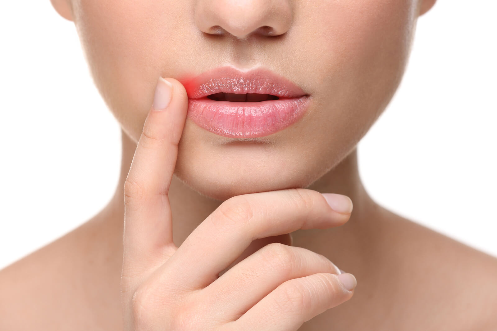 how-to-get-rid-of-cold-sores-fast